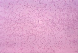 Pasteurella Multocida